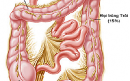 cách phòng ngừa bệnh viêm đại tràng