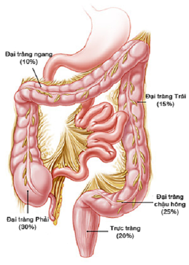 Cách phòng ngừa bệnh viêm đại tràng