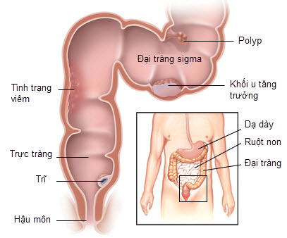 dai-trang-la-gi1