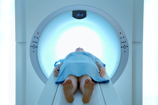 Nguyên nhân viêm trực tràng do xạ trị ung thư