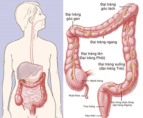 Bệnh viêm đại tràng có nguy hiểm không?