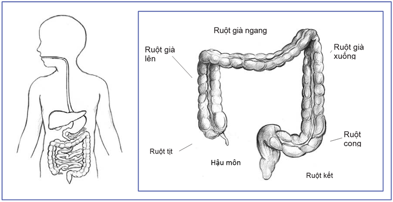 dung-chu-quan-voi-hoi-chung-ruot-kich-thich-o-tre-nho