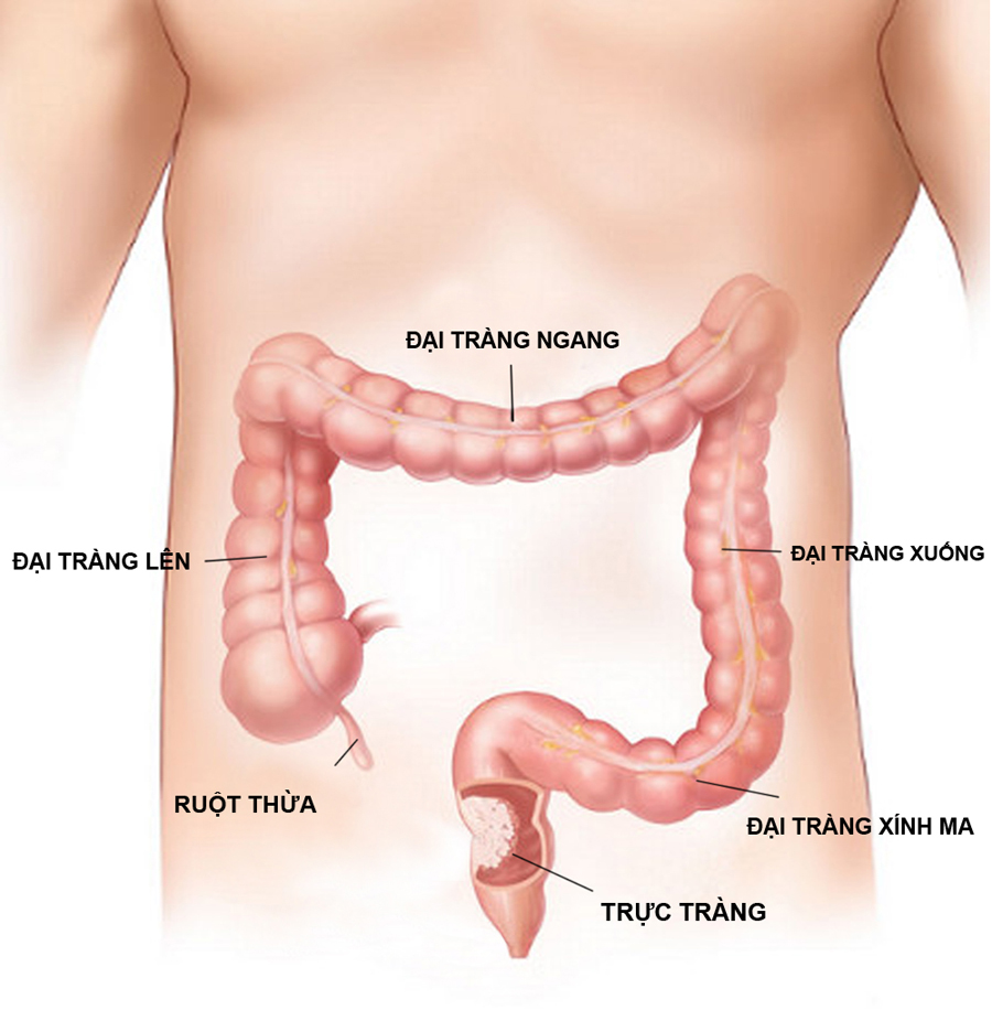 viem-niem-mac-truc-trang-uong-thuoc-gi-nhanh-khoi