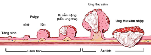 thuoc-dong-y-chua-benh-ung-thu-dai-trang1