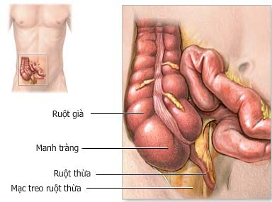  viêm manh tràng có nguy hiểm không