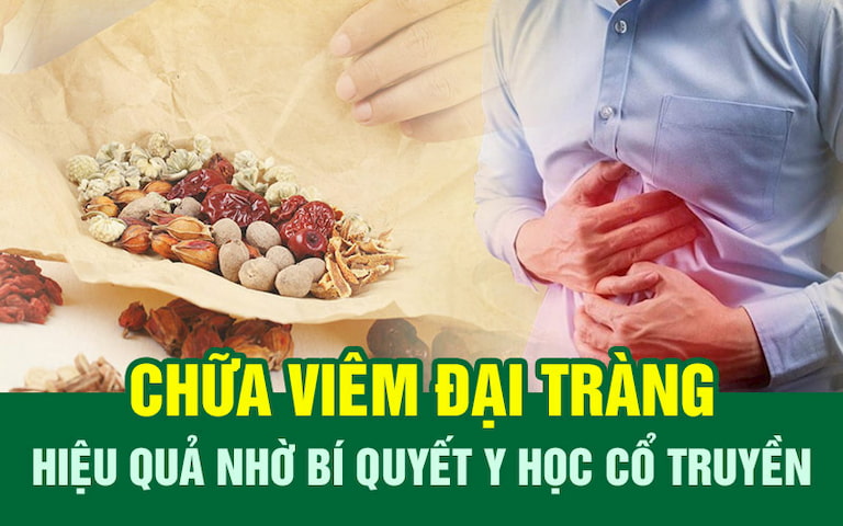 Các phương pháp YHCT là lựa chọn tối ưu cho người viêm đại tràng